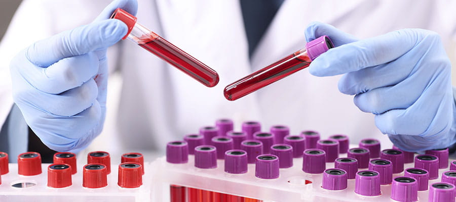 Blood Tests